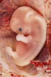 Lidsk embryo